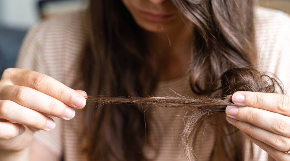 Young woman has hair loss problem. Loosing hair after covid disease. Care shampoo for repairing thin