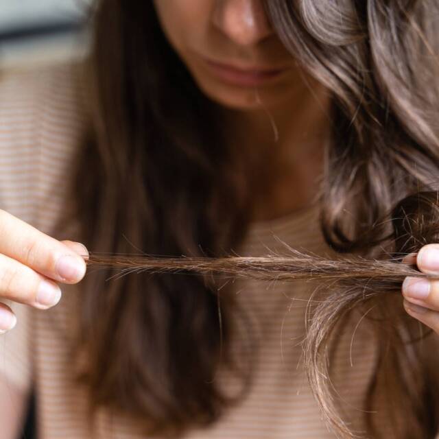 Young woman has hair loss problem. Loosing hair after covid disease. Care shampoo for repairing thin